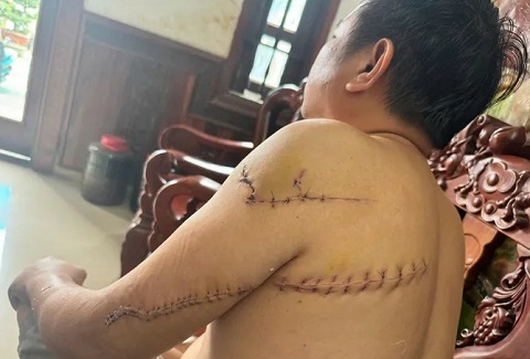 Mở rộng điều tra vụ truy sát dã man giữa ban ngày