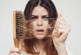 5 lý do khiến bạn bị rụng tóc nhanh chóng
