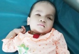 Xót xa bé gái 2 tuổi bị u võng mạc 2 mắt