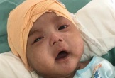 Ánh mắt cầu cứu của bé trai 5 tháng tuổi toàn thân lở loét vì căn bệnh quái ác
