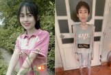 Nhịn ăn cơm để giảm cân, cô gái Hưng Yên xinh xắn có tiếng chỉ còn 18 kg, cơ thể còn da bọc xương