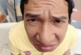 Nam NSƯT có chiếc mũi to 