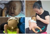 Trái tim thắt nghẹn trước nỗi đau bé 7 tháng tuổi cần ghép gan